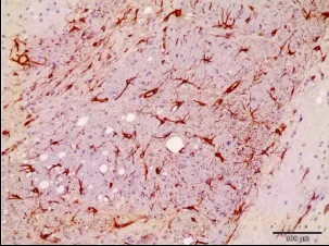 Oferta beca FPU Dirigido a Licenciados en Biología o Bioquímica