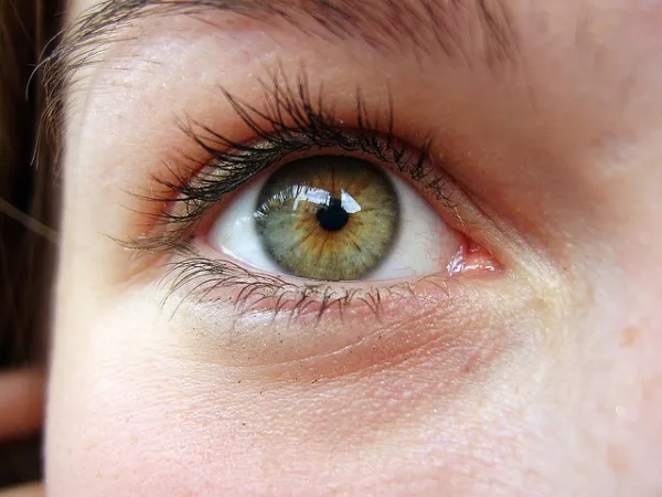 Queratocono y ectasias corneales